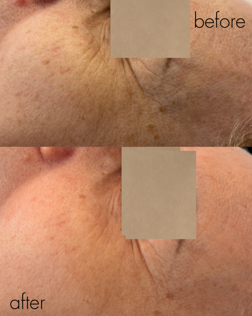 Laseroterapia – Klinika Naturalnie w Czeladzi